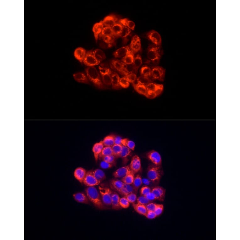 Immunofluorescence - Anti-Albumin Antibody (A13438) - Antibodies.com