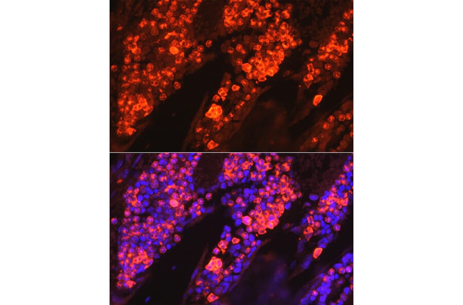Immunofluorescence - Anti-Myeloperoxidase Antibody (A13440) - Antibodies.com