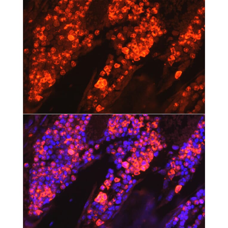 Anti myeloperoxidase antibody a13440 antibodies