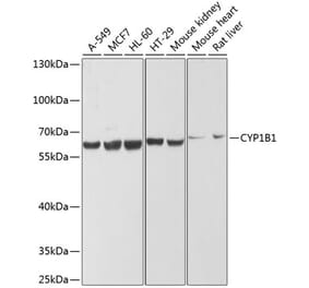 Western Blot - Anti-CYP1B1 Antibody (A13441) - Antibodies.com