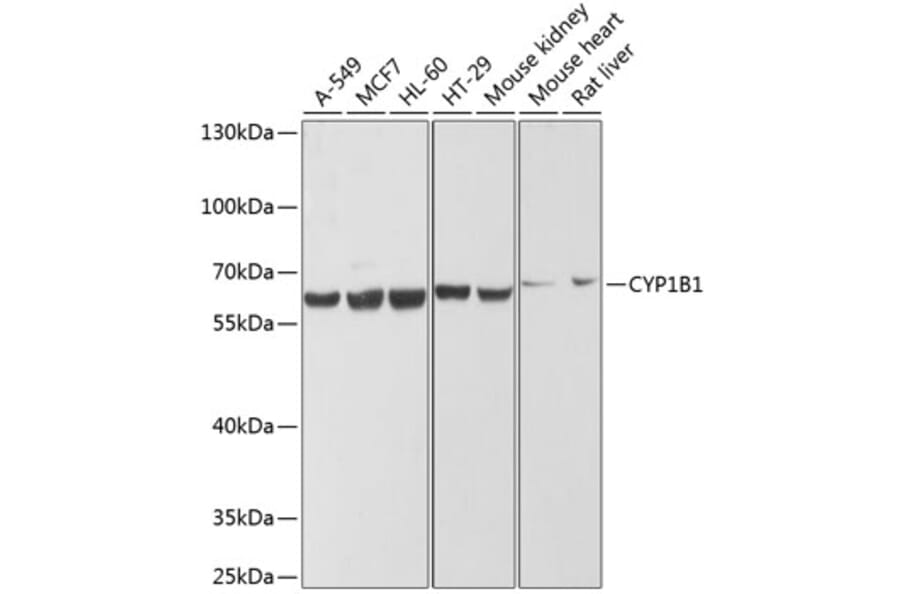 Western Blot - Anti-CYP1B1 Antibody (A13441) - Antibodies.com