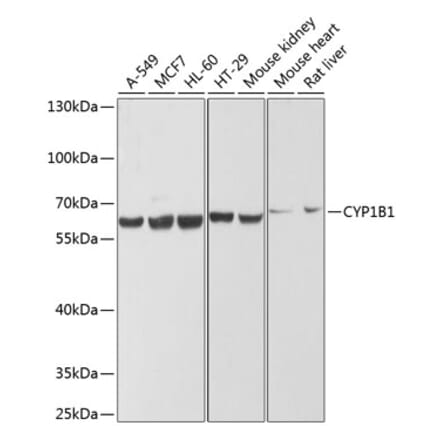 Western Blot - Anti-CYP1B1 Antibody (A13441) - Antibodies.com