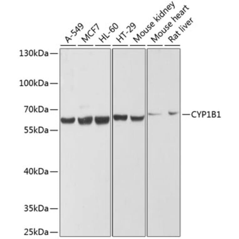 Western Blot - Anti-CYP1B1 Antibody (A13441) - Antibodies.com