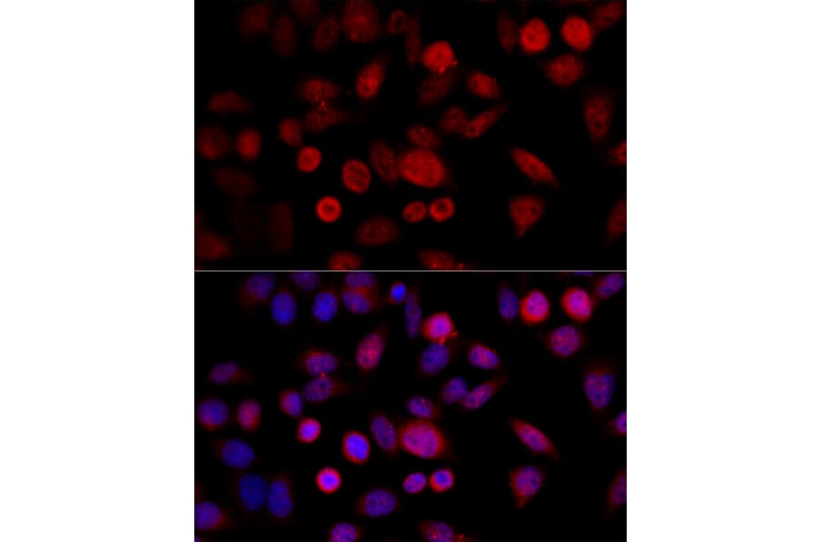 Immunofluorescence - Anti-CYP1B1 Antibody (A13441) - Antibodies.com