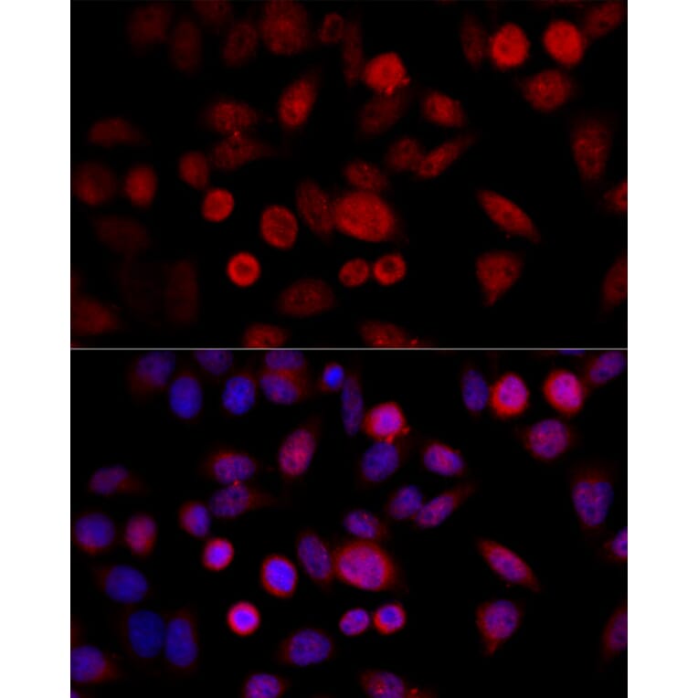 Immunofluorescence - Anti-CYP1B1 Antibody (A13441) - Antibodies.com