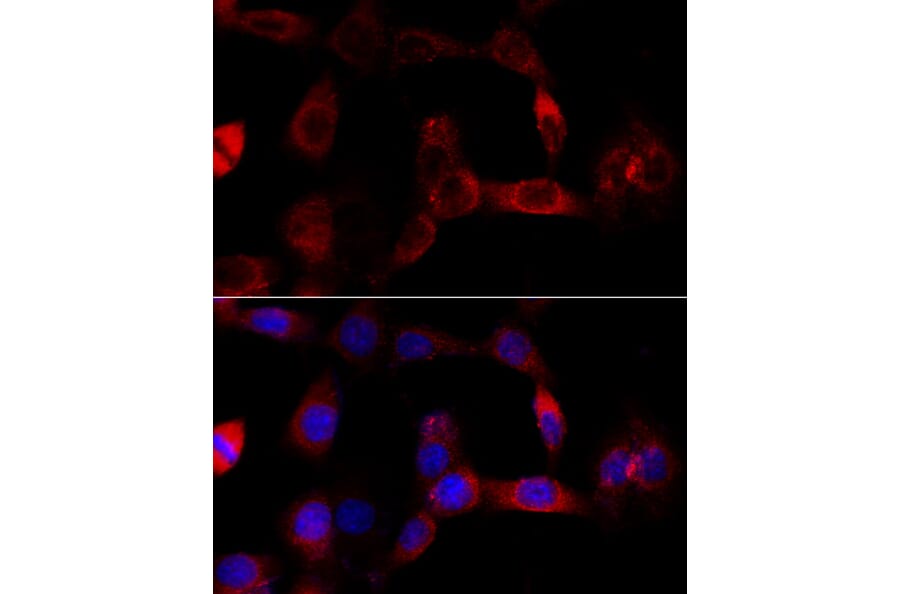 Immunofluorescence - Anti-CYP1B1 Antibody (A13441) - Antibodies.com