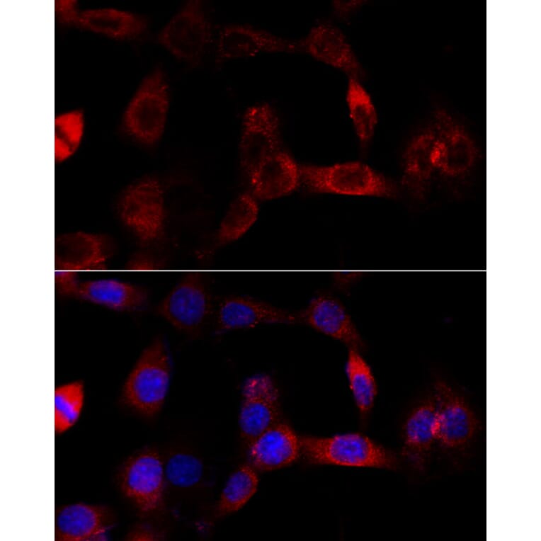 Immunofluorescence - Anti-CYP1B1 Antibody (A13441) - Antibodies.com