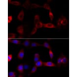 Immunofluorescence - Anti-CYP1B1 Antibody (A13441) - Antibodies.com