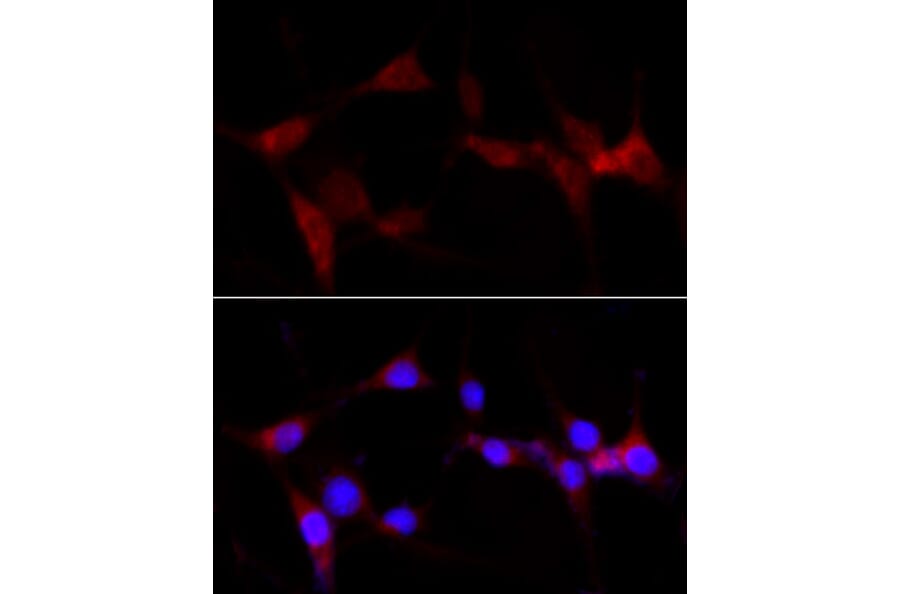 Immunofluorescence - Anti-CYP1B1 Antibody (A13441) - Antibodies.com