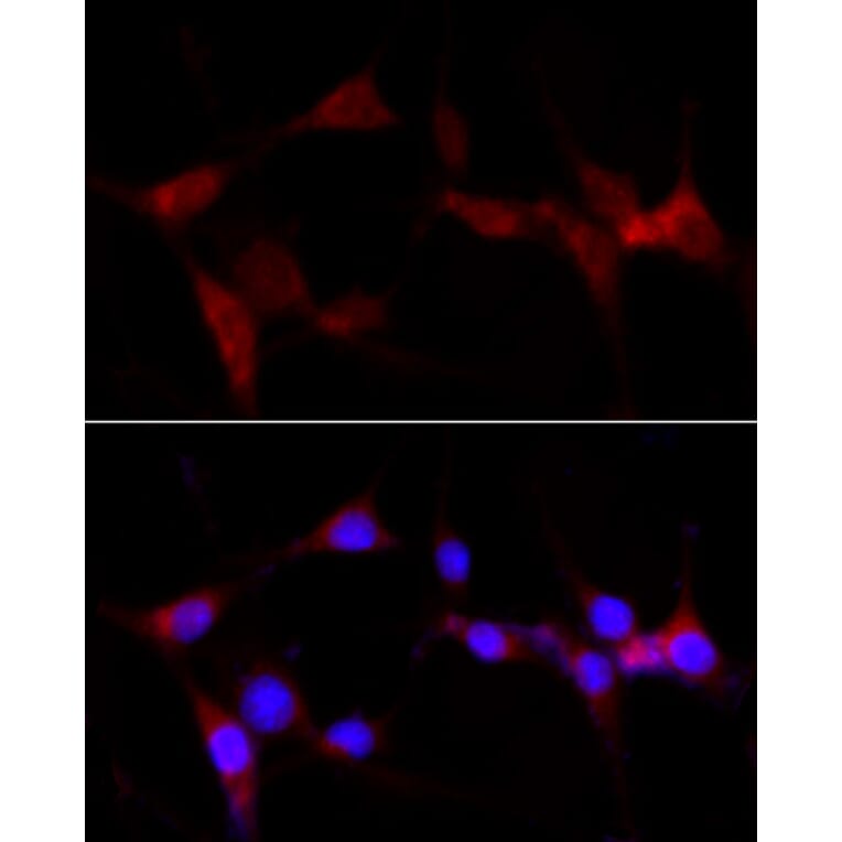 Immunofluorescence - Anti-CYP1B1 Antibody (A13441) - Antibodies.com