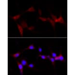 Immunofluorescence - Anti-CYP1B1 Antibody (A13441) - Antibodies.com