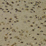 Immunohistochemistry - Anti-Ogg1 Antibody (A13442) - Antibodies.com