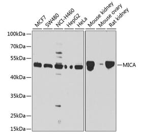 Western Blot - Anti-MICA Antibody (A13443) - Antibodies.com
