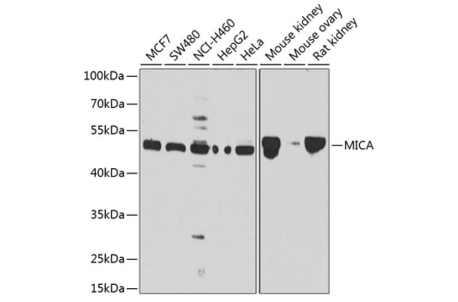 Western Blot - Anti-MICA Antibody (A13443) - Antibodies.com