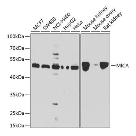 Western Blot - Anti-MICA Antibody (A13443) - Antibodies.com