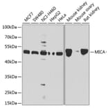 Western Blot - Anti-MICA Antibody (A13443) - Antibodies.com