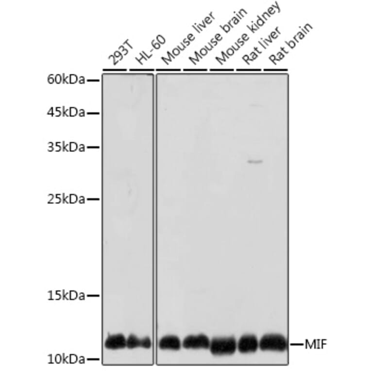Western Blot - Anti-MIF Antibody (A13444) - Antibodies.com