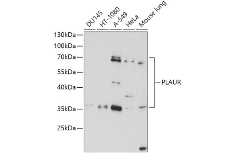 Western Blot - Anti-uPA Receptor/U-PAR Antibody (A13445) - Antibodies.com