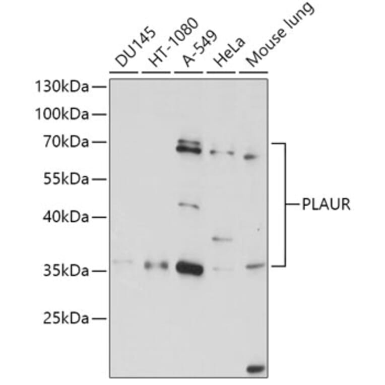 Western Blot - Anti-uPA Receptor/U-PAR Antibody (A13445) - Antibodies.com