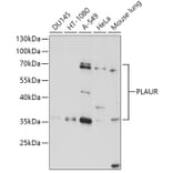 Western Blot - Anti-uPA Receptor/U-PAR Antibody (A13445) - Antibodies.com