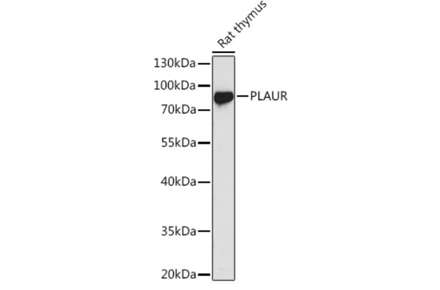 Western Blot - Anti-uPA Receptor/U-PAR Antibody (A13445) - Antibodies.com