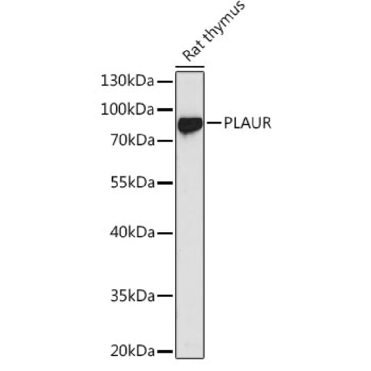 Western Blot - Anti-uPA Receptor/U-PAR Antibody (A13445) - Antibodies.com