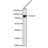 Western Blot - Anti-uPA Receptor/U-PAR Antibody (A13445) - Antibodies.com