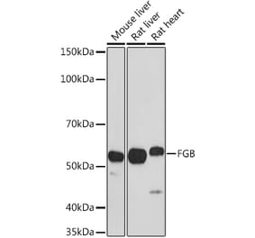 Western Blot - Anti-Fibrinogen beta chain Antibody (A13446) - Antibodies.com