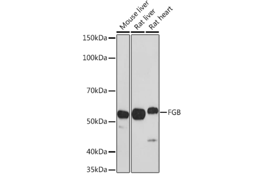 Western Blot - Anti-Fibrinogen beta chain Antibody (A13446) - Antibodies.com