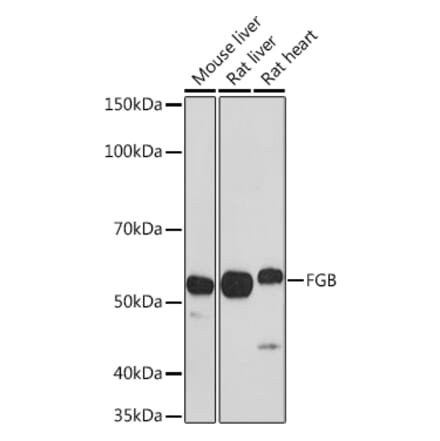 Western Blot - Anti-Fibrinogen beta chain Antibody (A13446) - Antibodies.com