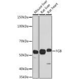 Western Blot - Anti-Fibrinogen beta chain Antibody (A13446) - Antibodies.com