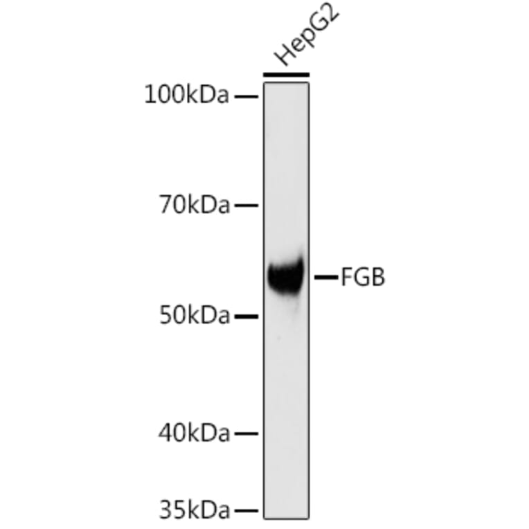 Western Blot - Anti-Fibrinogen beta chain Antibody (A13446) - Antibodies.com