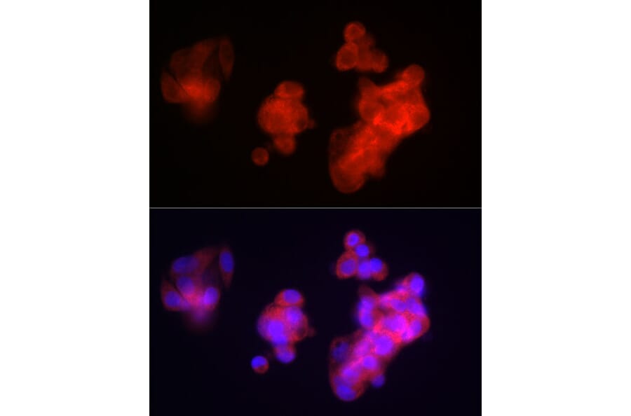 Immunofluorescence - Anti-Fibrinogen beta chain Antibody (A13446) - Antibodies.com