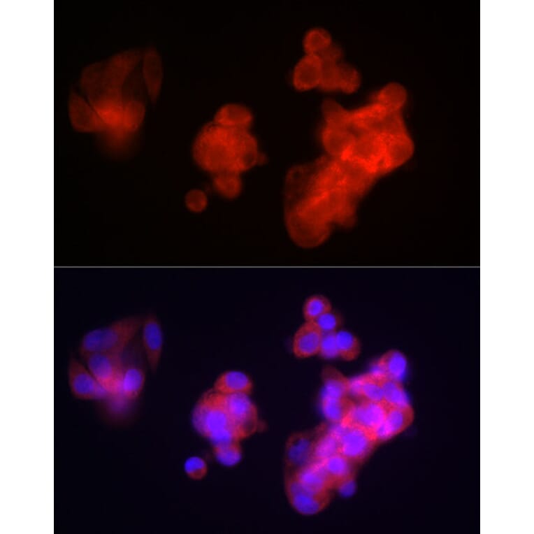 Immunofluorescence - Anti-Fibrinogen beta chain Antibody (A13446) - Antibodies.com