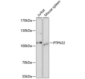 Western Blot - Anti-PTPN22 Antibody (A13447) - Antibodies.com