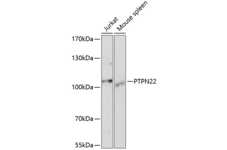 Western Blot - Anti-PTPN22 Antibody (A13447) - Antibodies.com