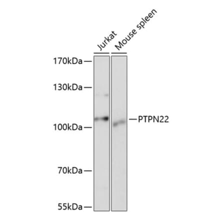 Western Blot - Anti-PTPN22 Antibody (A13447) - Antibodies.com