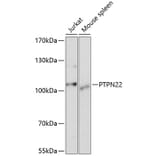 Western Blot - Anti-PTPN22 Antibody (A13447) - Antibodies.com