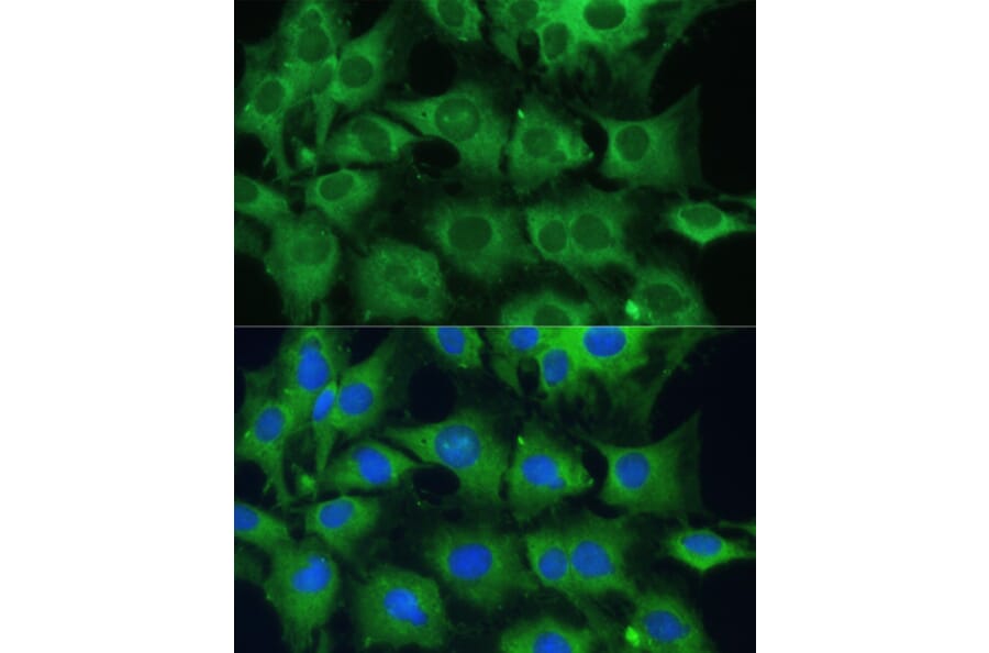 Immunofluorescence - Anti-PTPN22 Antibody (A13447) - Antibodies.com