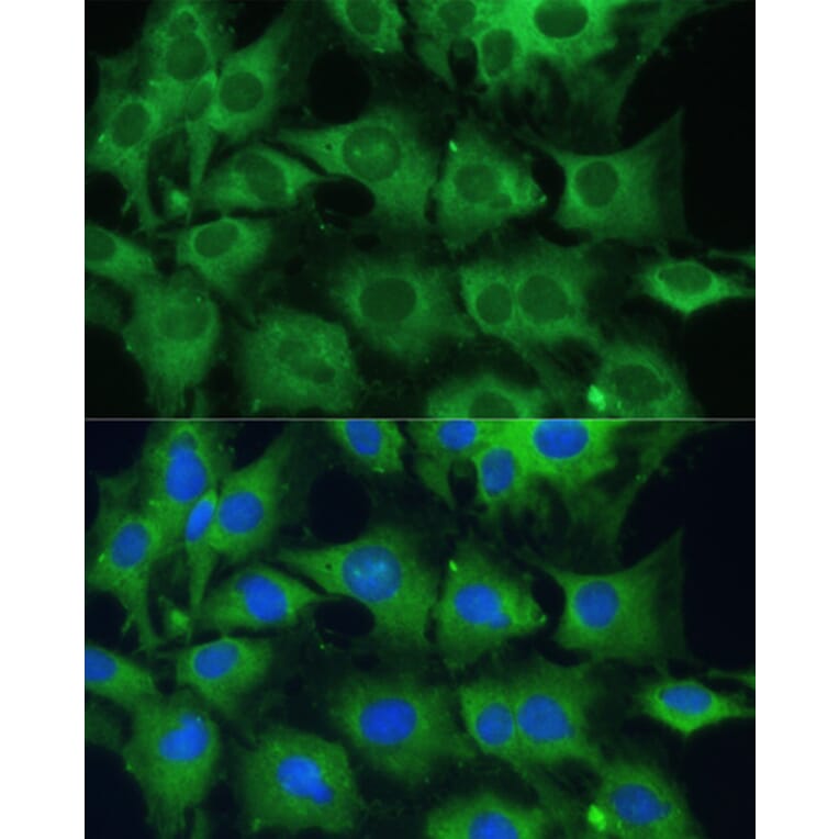 Immunofluorescence - Anti-PTPN22 Antibody (A13447) - Antibodies.com