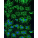 Immunofluorescence - Anti-PTPN22 Antibody (A13447) - Antibodies.com