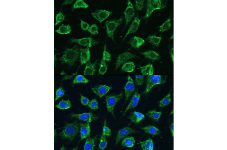 Immunofluorescence - Anti-PTPN22 Antibody (A13447) - Antibodies.com