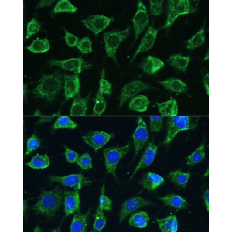 Immunofluorescence - Anti-PTPN22 Antibody (A13447) - Antibodies.com