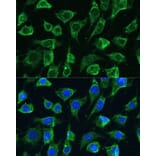 Immunofluorescence - Anti-PTPN22 Antibody (A13447) - Antibodies.com