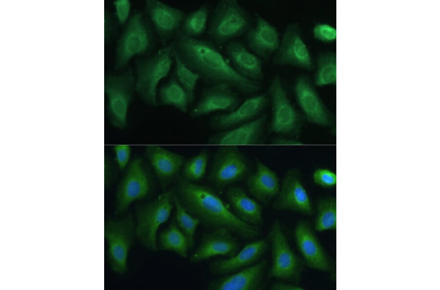 Immunofluorescence - Anti-PTPN22 Antibody (A13447) - Antibodies.com