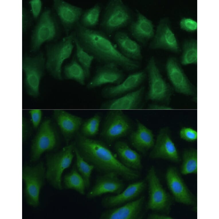 Immunofluorescence - Anti-PTPN22 Antibody (A13447) - Antibodies.com