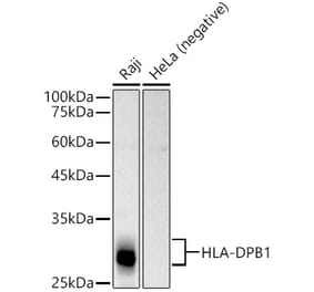 Western Blot - Anti-MHC Class II beta Antibody (A13448) - Antibodies.com