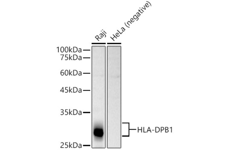 Western Blot - Anti-MHC Class II beta Antibody (A13448) - Antibodies.com
