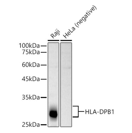 Western Blot - Anti-MHC Class II beta Antibody (A13448) - Antibodies.com