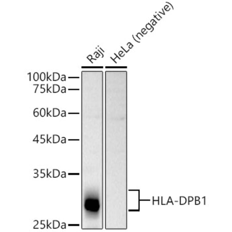 Western Blot - Anti-MHC Class II beta Antibody (A13448) - Antibodies.com